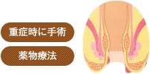 重症時に手術　薬物療法